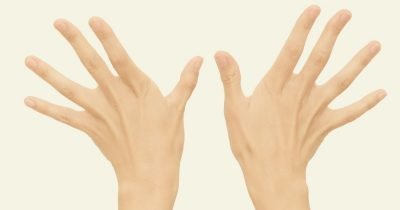 Finger rückwärts gebogen, alle 10 Finger gespreizt